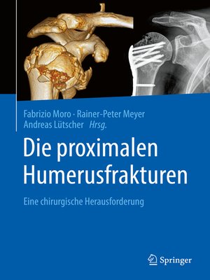 cover image of Die proximalen Humerusfrakturen